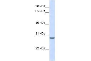 Tetraspanin 6 antibody used at 1 ug/ml to detect target protein. (Tetraspanin 6 antibody  (N-Term))