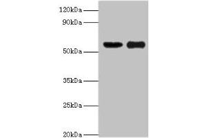 Western blot All lanes: OXCT1 antibody at 8 μg/mL Lane 1: Mouse heart tissue Lane 2: Mouse kidney tissue Secondary Goat polyclonal to rabbit IgG at 1/10000 dilution Predicted band size: 57, 14 kDa Observed band size: 57 kDa