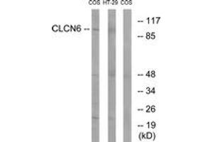 Western blot analysis of extracts from COS7/HT-29 cells, using CLCN6 Antibody. (CLCN6 antibody  (AA 611-660))