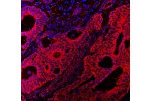 IF analysis of VAPA using anti-VAPA antibody (ABIN7603249). (VAPA antibody  (N-Term))