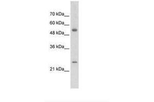 Image no. 1 for anti-Adenylate Kinase 4 (AK4) (AA 126-175) antibody (ABIN203378) (AK4 antibody  (AA 126-175))