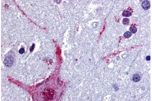 Human Brain, Cortex (formalin-fixed, paraffin-embedded) stained with CHRM3 antibody ABIN213349 at 5 ug/ml followed by biotinylated goat anti-rabbit IgG secondary antibody ABIN481713, alkaline phosphatase-streptavidin and chromogen. (CHRM3 antibody  (Cytoplasmic Domain))