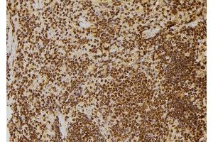 ABIN6277712 at 1/100 staining Rat spleen tissue by IHC-P. (TP53BP1 antibody  (N-Term))