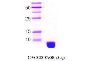 Figure annotation denotes ug of protein loaded and % gel used. (Ubiquitin Protein (Ubiquitin))