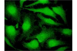 Immunofluorescence of monoclonal antibody to CITED4 on HeLa cell. (CITED4 antibody  (AA 131-184))