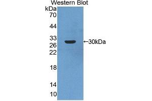 Detection of Recombinant ARNT2, Human using Polyclonal Antibody to Aryl Hydrocarbon Receptor Nuclear Translocator 2 (ARNT2) (ARNT2 antibody  (AA 1-209))