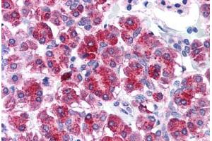 Human Pancreas (formalin-fixed, paraffin-embedded) stained with TLR3 antibody ABIN214574 at 5 ug/ml followed by biotinylated goat anti-rabbit IgG secondary antibody ABIN481713, alkaline phosphatase-streptavidin and chromogen. (TLR3 antibody  (N-Term))