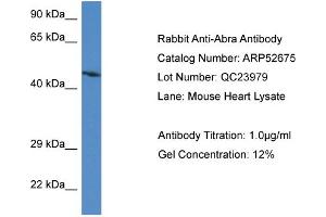 Western Blotting (WB) image for anti-Actin-Binding rho Activating Protein (ABRA) (C-Term) antibody (ABIN2785042) (ABRA antibody  (C-Term))