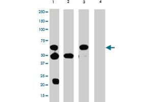 Immunoprecipitation (IP) / Western Blot (WB) Analysis of TERF2 in HL-60 cells : (Lane 1) IP with mouse TERF2 monoclonal antibody, clone 4A794.