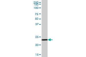 GSTZ1 MaxPab polyclonal antibody. (GSTZ1 antibody  (AA 1-216))