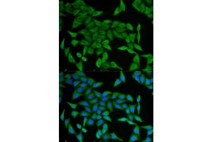 Immunofluorescence (IF) image for anti-Cellular Retinoic Acid Binding Protein 2 (CRABP2) antibody (ABIN1882301) (CRABP2 antibody)