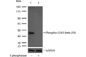 anti-Glycogen Synthase Kinase 3 beta (GSK3b) (pSer9) antibody