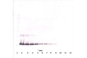 Image no. 1 for anti-Interleukin 2 (IL2) antibody (ABIN465129) (IL-2 antibody)