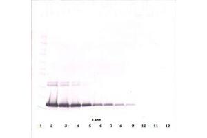 Image no. 1 for anti-Interleukin 2 (IL2) antibody (ABIN465129)