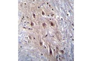 Immunohistochemistry analysis in formalin fixed and paraffin embedded human brain tissue reacted with HIPK4 Antibody  followed by peroxidase conjugation of the secondary antibody and DAB staining. (HIPK4 antibody)