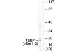 Western blot analysis of extracts from NIH-3T3 cells treated with EGF 200ng/ml 30', using TEBP (Phospho-Ser113) Antibody. (NKX2-1 antibody  (pSer113))