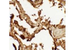 Immunohistochemistry of VKORC1 in human lung tissue with VKORC1 antibody at 2. (VKORC1 antibody  (N-Term))