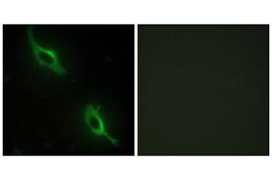 Immunofluorescence analysis of NIH/3T3 cells, using CKMT2 antibody.