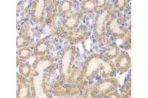 Immunohistochemistry of paraffin-embedded Rat kidney using EYA3 Polyclonal Antibody at dilution of 1:100 (40x lens). (EYA3 antibody)