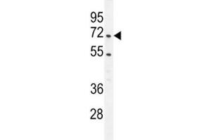 CARM1 antibody  (AA 346-377)