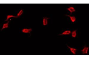 ABIN6272289 staining COLO205 by IF/ICC. (DNAI1 antibody  (C-Term))