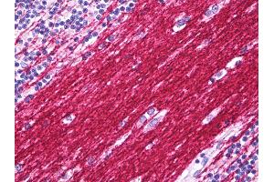 Anti-PLP1 antibody IHC of human brain cerebellum, neuropil. (PLP1 antibody  (C-Term))