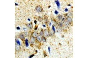 Immunohistochemical analysis of GCN2 staining in rat brain  formalin fixed paraffin embedded tissue section.