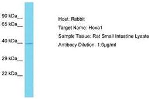 Image no. 1 for anti-Homeobox A1 (HOXA1) (AA 251-300) antibody (ABIN6750256) (HOXA1 antibody  (AA 251-300))