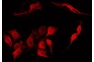 Immunofluorescence (fixed cells) (IF/ICC) image for anti-Transforming, Acidic Coiled-Coil Containing Protein 1 (TACC1) (N-Term) antibody (ABIN6265428)
