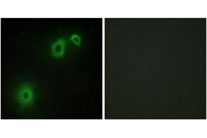 Immunofluorescence analysis of A549 cells, using TNR16 Antibody. (NGFR antibody  (AA 121-170))