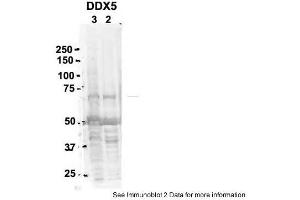Sample Type: 2. (DDX5 antibody  (C-Term))