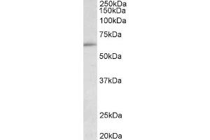ABIN1049504 (0. (HIC2 antibody  (AA 188-200))