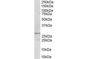 Western Blotting (WB) image for anti-Docking Protein 5 (DOK5) (AA 293-306) antibody (ABIN299685)