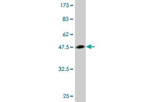 Western Blot detection against Immunogen (43. (TWIST2 antibody  (AA 1-160))