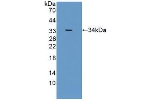 CRAT antibody  (AA 363-626)