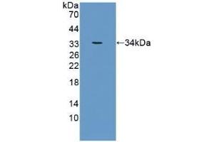 Detection of Recombinant CRAT, Human using Polyclonal Antibody to Carnitine Acetyltransferase (CRAT) (CRAT antibody  (AA 363-626))