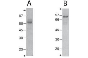 COMP Protein (C-Term)