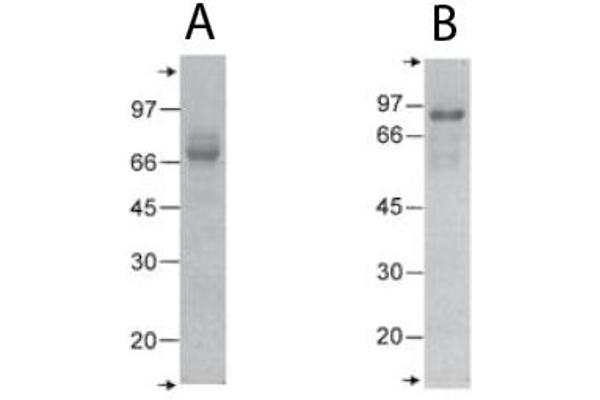 COMP Protein (C-Term)