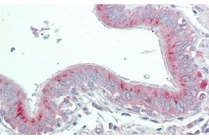 Detection of PLA2R1 in Human Lung Tissue using Polyclonal Antibody to Phospholipase A2 Receptor 1 (PLA2R1)