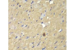 Immunohistochemistry of paraffin-embedded Mouse heart using AKR7A2 Polyclonal Antibody at dilution of 1:100 (40x lens). (AKR7A2 antibody)