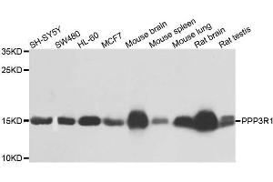 Western blot analysis of extracts of various cell lines, using PPP3R1 antibody. (PPP3R1 antibody  (AA 11-170))