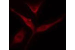 ABIN6274546 staining COLO205 cells by IF/ICC. (IKZF3 antibody  (Internal Region))