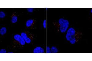 Immunofluorescent staining of HeLa cells incubated with MIB1 polyclonal antibody .
