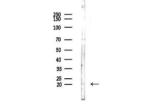 Western blot analysis of lysates from COLO205 cells(UV,30 min treatment), using CL2 Antibody at 1/1000 dilution. (CD164L2 antibody)