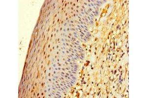 Immunohistochemistry of paraffin-embedded human tonsil tissue using ABIN7176409 at dilution of 1:100 (ZNF586 antibody  (AA 1-210))