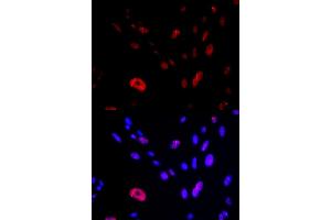 Immunofluorescence analysis of U2OS cells using HUS1 antibody (ABIN6131777, ABIN6142085, ABIN6142087 and ABIN6221056). (HUS1 antibody  (AA 1-280))