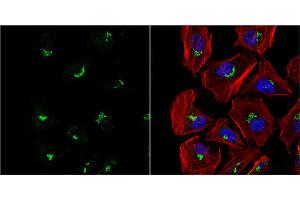 ICC/IF Image VBP1 antibody detects VBP1 protein at cytoplasm by immunofluorescent analysis. (VBP1 antibody  (Center))