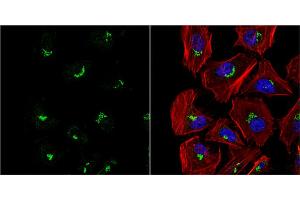 ICC/IF Image VBP1 antibody detects VBP1 protein at cytoplasm by immunofluorescent analysis.