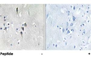 Immunohistochemical analysis of paraffin-embedded human brain tissue using CAMK2A/CAMK2D polyclonal antibody . (CAMK2A antibody)