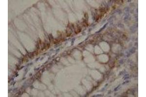 Image no. 1 for anti-rho-Associated, Coiled-Coil Containing Protein Kinase 2 (ROCK2) (N-Term) antibody (ABIN1495063) (ROCK2 antibody  (N-Term))